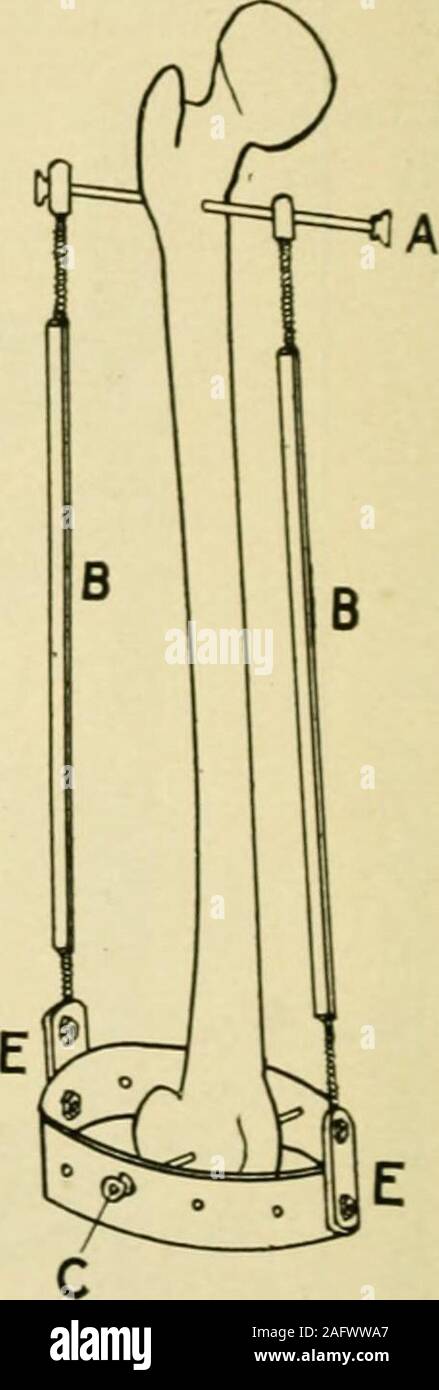 Screwed apart hi-res stock photography and images - Alamy