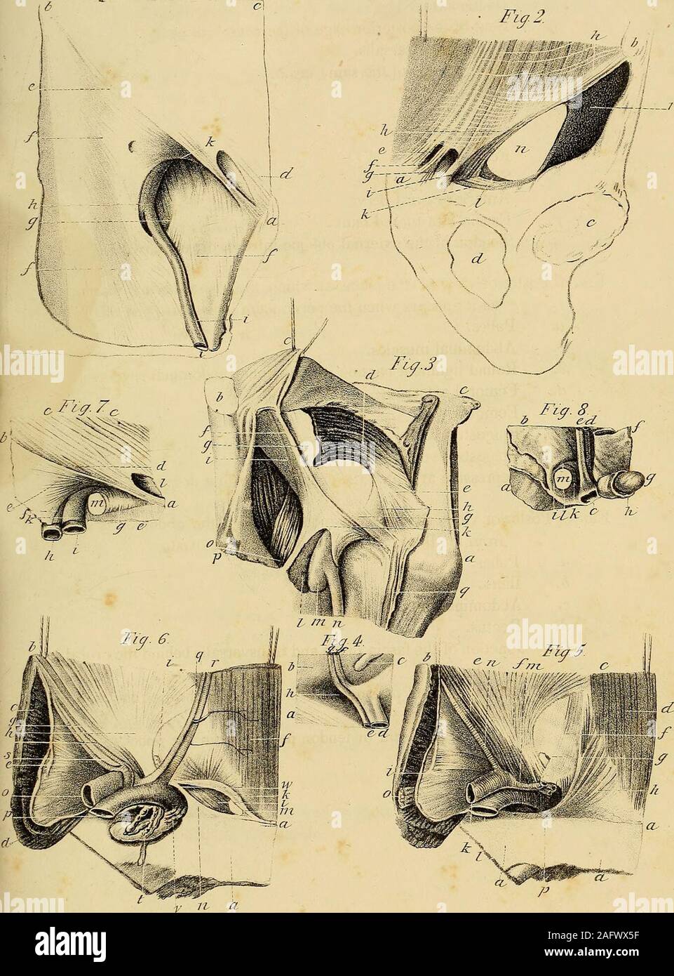 . The anatomy and surgical treatment of abdominal hernia. liaca. k. Femoral sheath. 7. Femoral artery. m. Femoral vein. n. Saphsena major vein. o. Anterior crural nerve. p. Fascia lata turned back. q. Tendon of the external oblique muscle, drawn down. Fig. 4. Posterior view of the place at which the crural hernia descends,as it appears when the peritoneum is first stripped off. a. Pubes. b. Abdominal muscles. c. Round ligament passing into the inner abdominal ring. d. Femoral artery. e. Femoral vein. /. Epigastric artery. g. Epigastric vein. h. Depression at which the crural hernia first desce Stock Photo