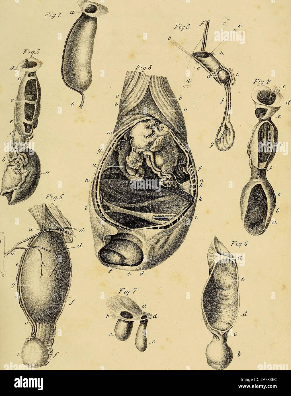 The anatomy and surgical treatment of abdominal hernia. l ring.6. Testis.c.  Femoral artery.ddd. External pudendal artery. e. Spermatic artery and vein.  f. Vas deferens. g. Hernial sac. Fig. 6. Hernial sac