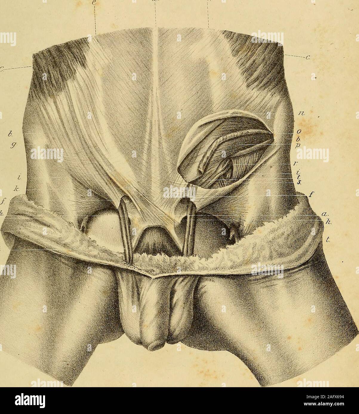 . The anatomy and surgical treatment of abdominal hernia. ansversalis, and by the epigastric artery,A portion of the fascia is fixed in the pubes, and another part of itpasses behind Pouparts ligament to unite with the femoral ves-sels. r. The place at which the spermatic cord goes into the abdomen. The fascia situated on its outer side and lower part, is of consi-derable density, but becoming thin upon its inner side, so as toshow the epigastric artery and vein behind it; from the edge ofthe fascia a thin layer is sent off which unites itself to the sper-matic cord, which fascia in this disse Stock Photo