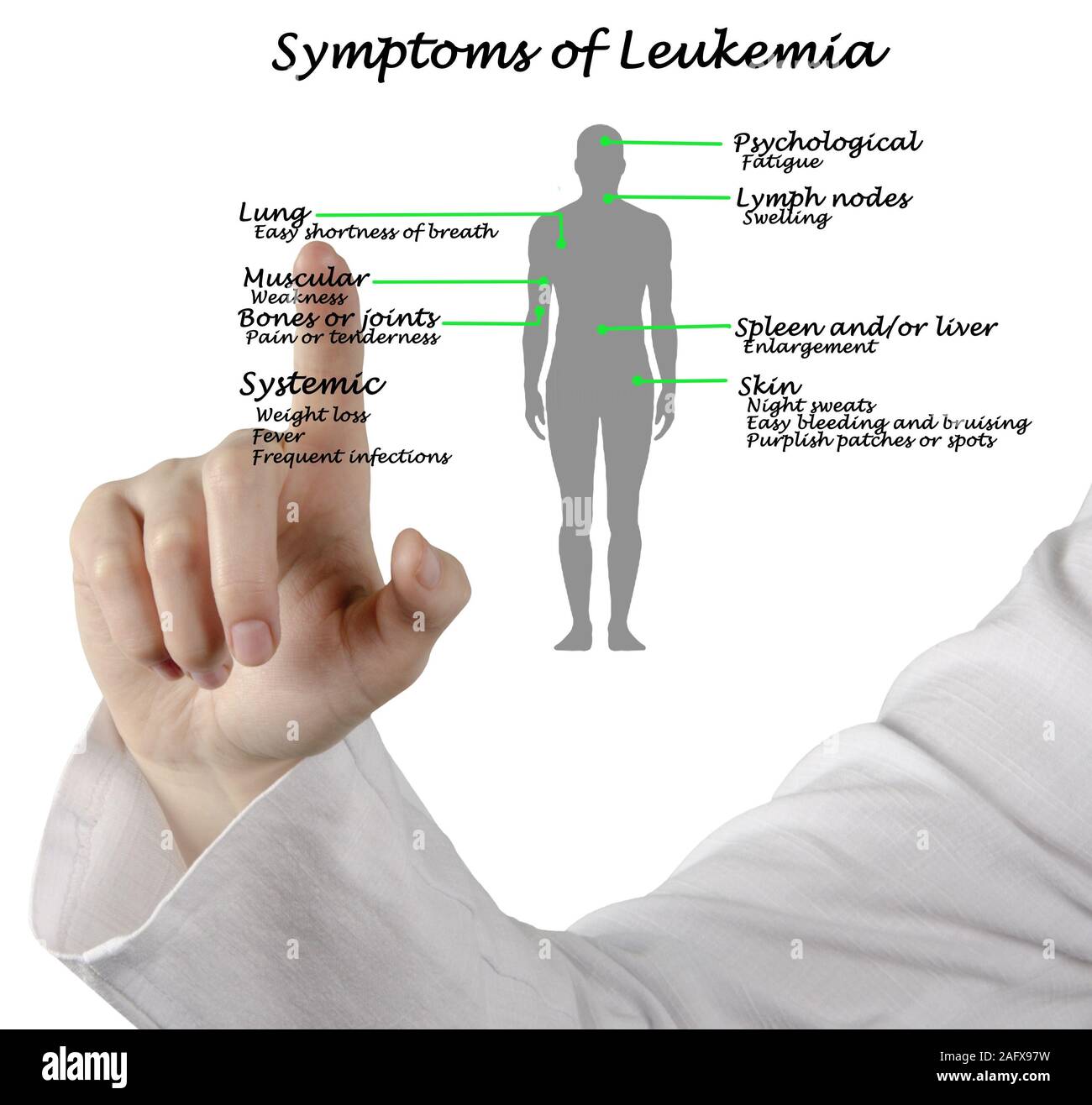 Common Symptoms of Leukemia Stock Photo Alamy