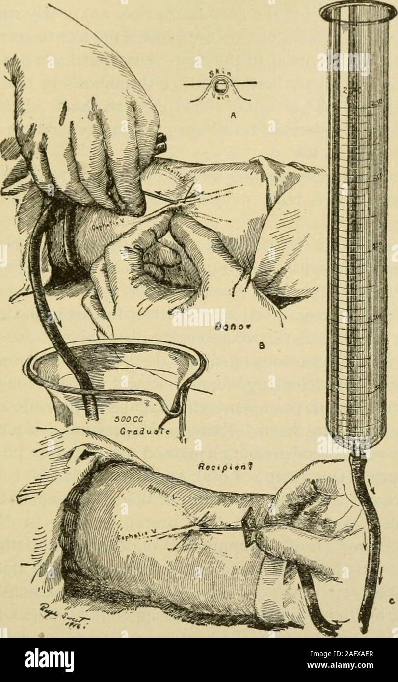 . Manual of operative surgery. e mediancephalic) and sterilize the skin