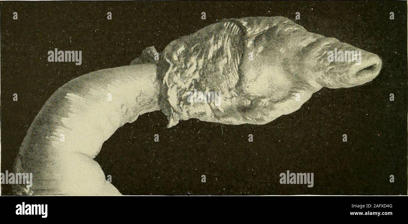 Hemorrhoidal veins hires stock photography and images Alamy