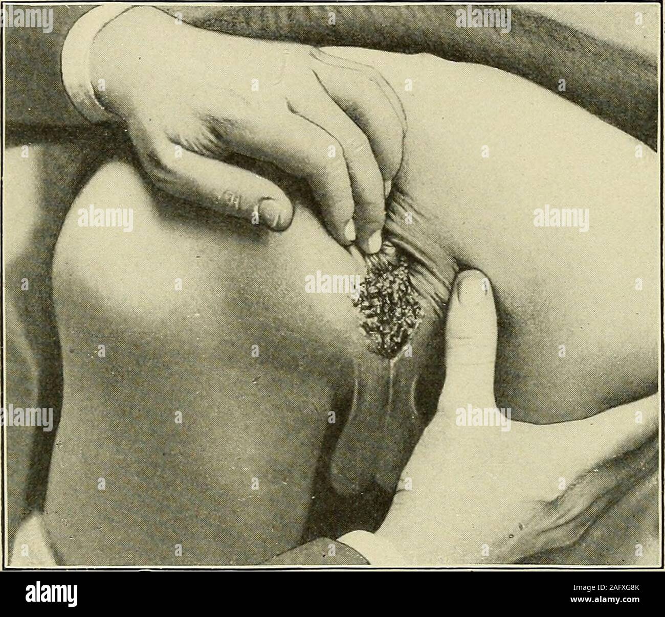 Anus fotosuratidagi it uslubi