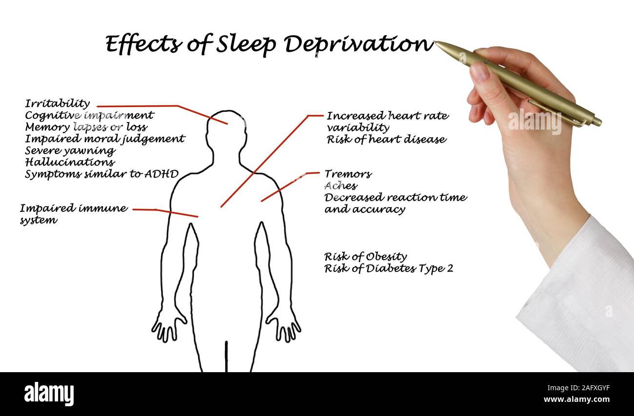Effects Of Sleep Deprivation Stock Photo Alamy