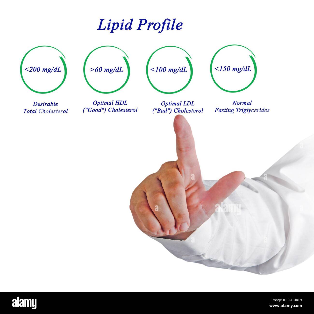 Lipid profile hires stock photography and images Alamy