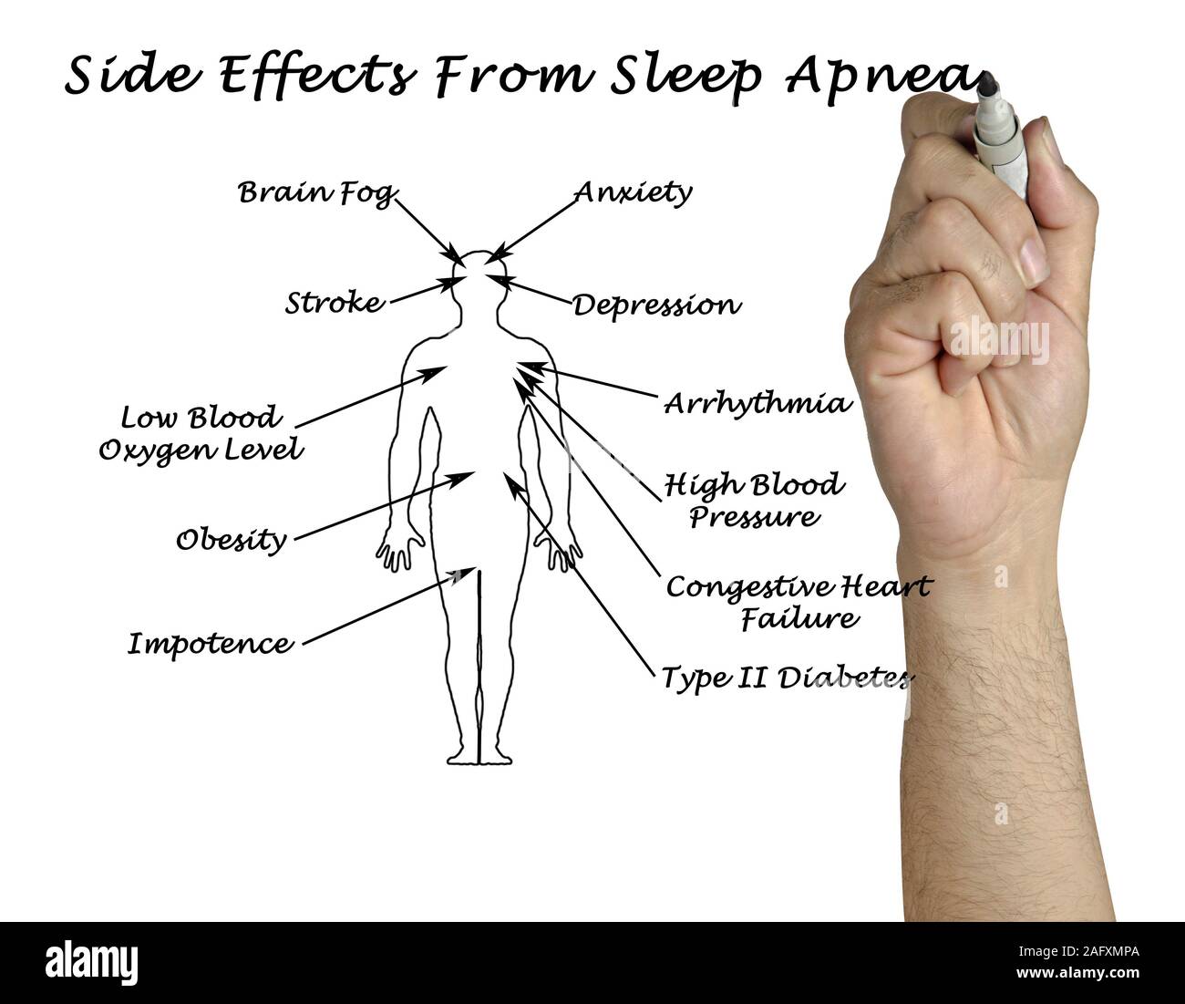 Side Effects From Sleep Apnea Stock Photo Alamy