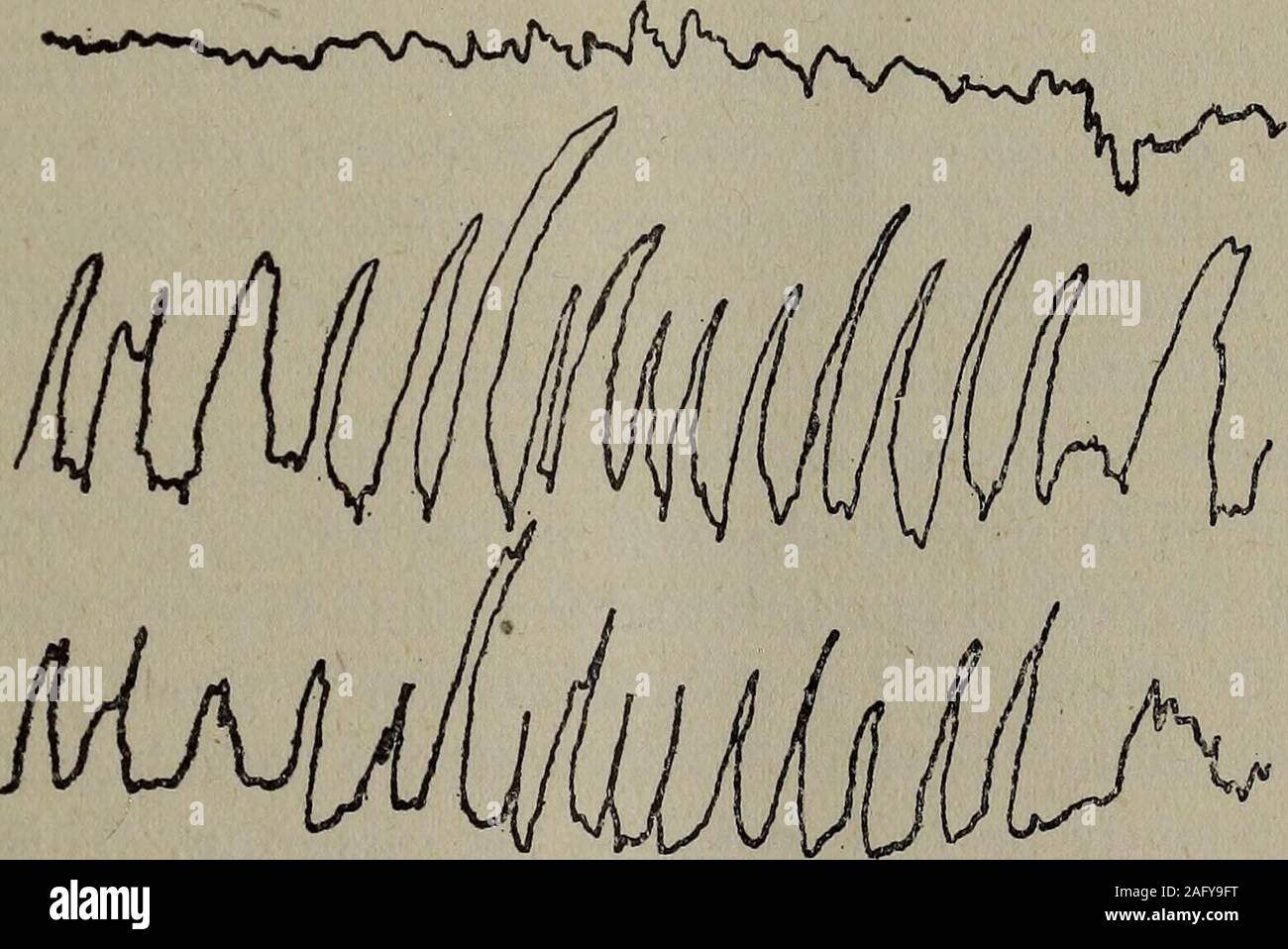 The Journal Of Mental Pathology Jtiiinbitnnajmiiii I1 Iiillimmii Ana Ala An No 3 F I 11 I Jii Irjjnii I R U 3a Ki Jon3 Gt A Jfiinita Szai Uix Lt Tvsjr X No 4 Idiot And Imbecile Children Various Causes Of Idiocy And Imbecility