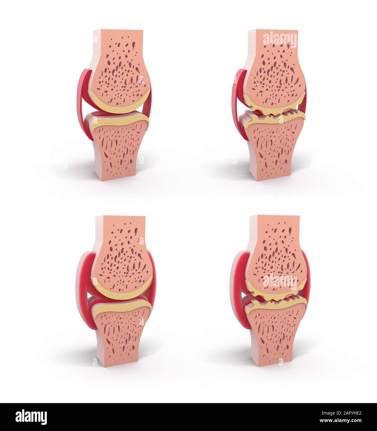 3d illustration of healthy and spherical synovial joint. In four representations standing and isolated on white background. Stock Photo