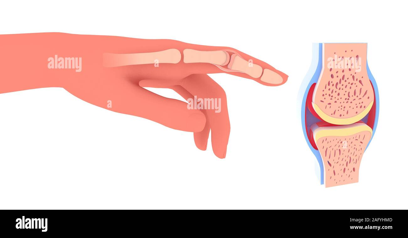 3d illustration of synovial joint. Next to the graphic representation of a hand placing the joint. Stock Photo