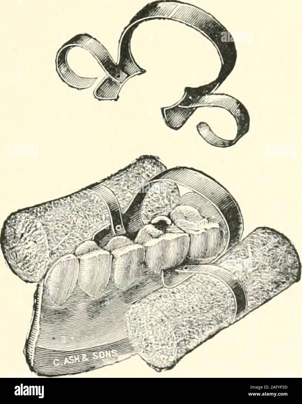 . The science and practice of dental surgery. Fig. 756.—Rogerss Wool-roll Long Ann Clamps (right and left lower molar). ? rrr,-&gt;i {Messrs. Claudius Ash, Sons cfc Co., Ltd.) Before fixmg any crown, the root and thecrown must be thoroughly cleaned and driedwith hot air, or ^^?ith absolute alcohol followed. Fic. 757.—Grosss Wool-roll Clamp. (Messrs. Claudius Ash,Sons tSi Co., Ltd.) by hot air. In some cases it is possible to applythe rubber-dam to the root, when the stump issufficiently preserved, but not often. To Achieve Dryness of the Root.—Have several 598 roughened Donaldson liristles rea Stock Photo