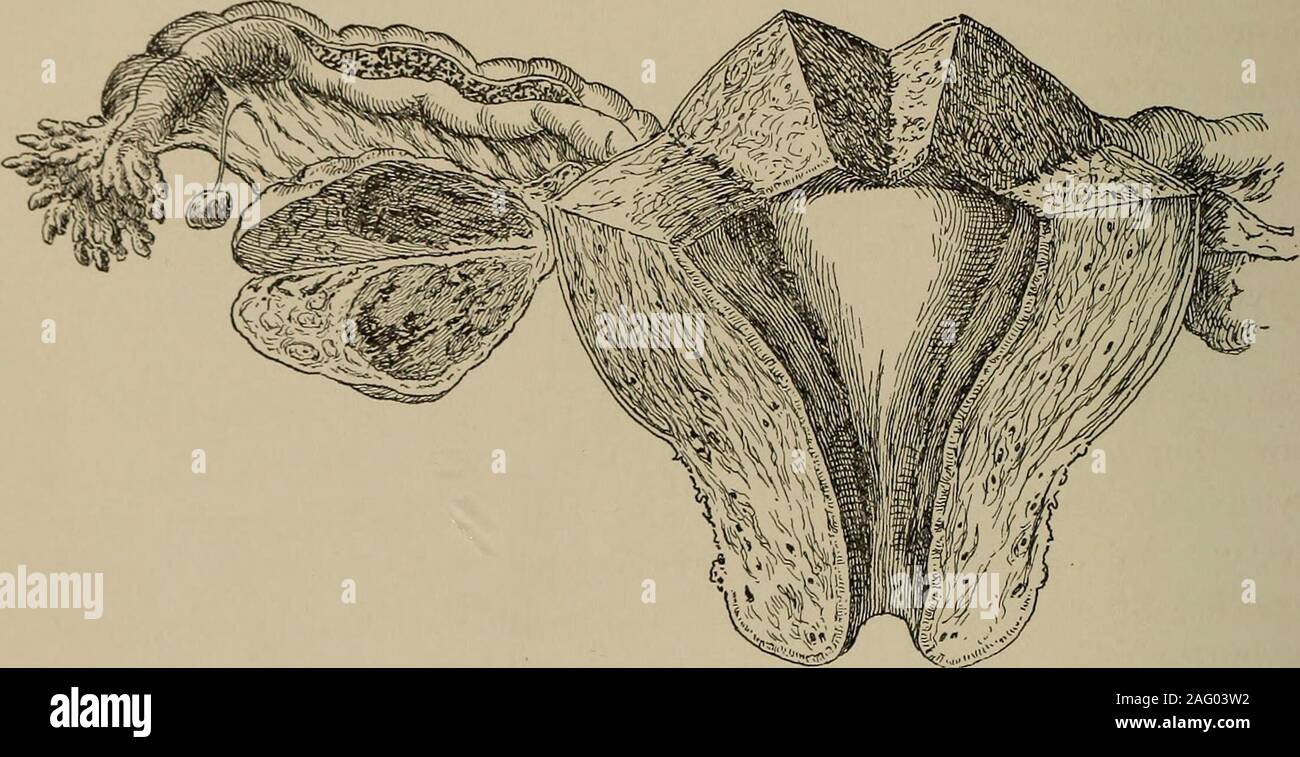 Oval Incision . Post-mortem pathology; a manual of post-mortem examinations and the ...