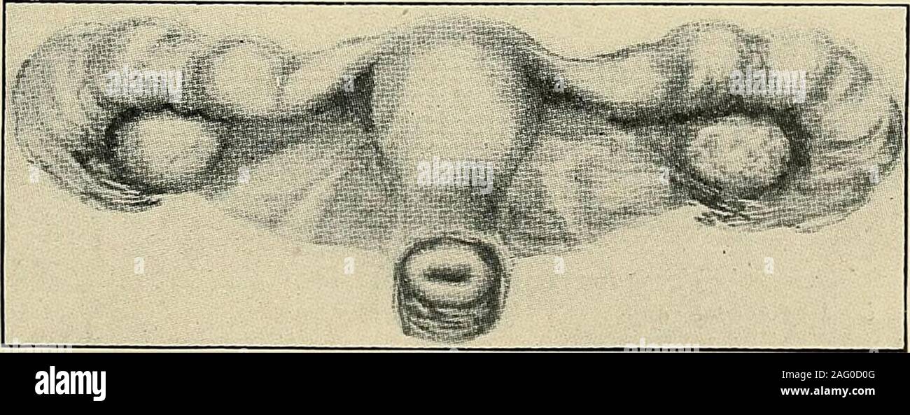 Induration Cyst Diagnosis diseases women cyst hi-res stock photography and images - Alamy