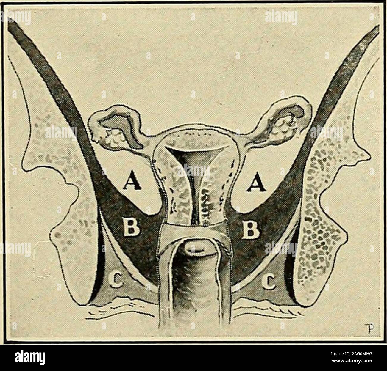 The diagnosis and treatment of diseases of women ecidedly tender