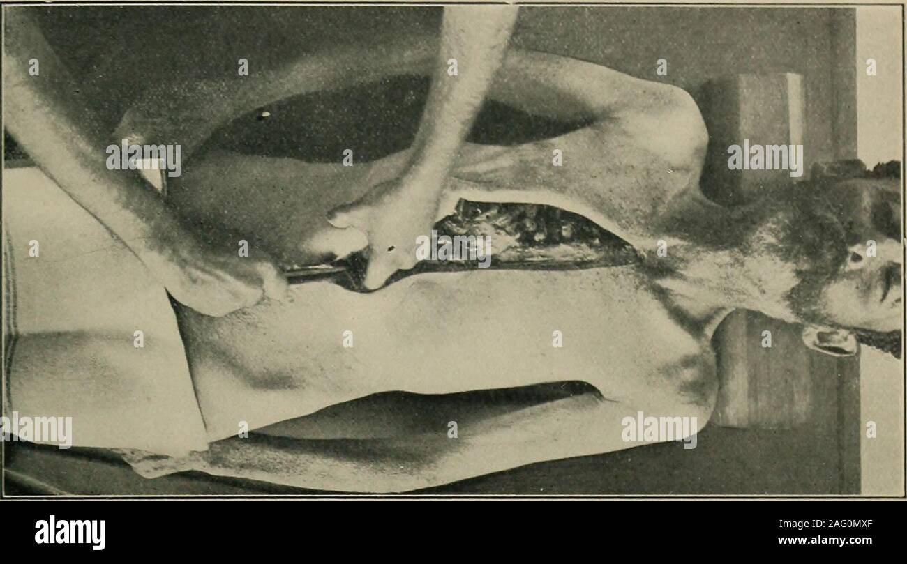 . Post-mortem pathology; a manual of post-mortem examinations and the