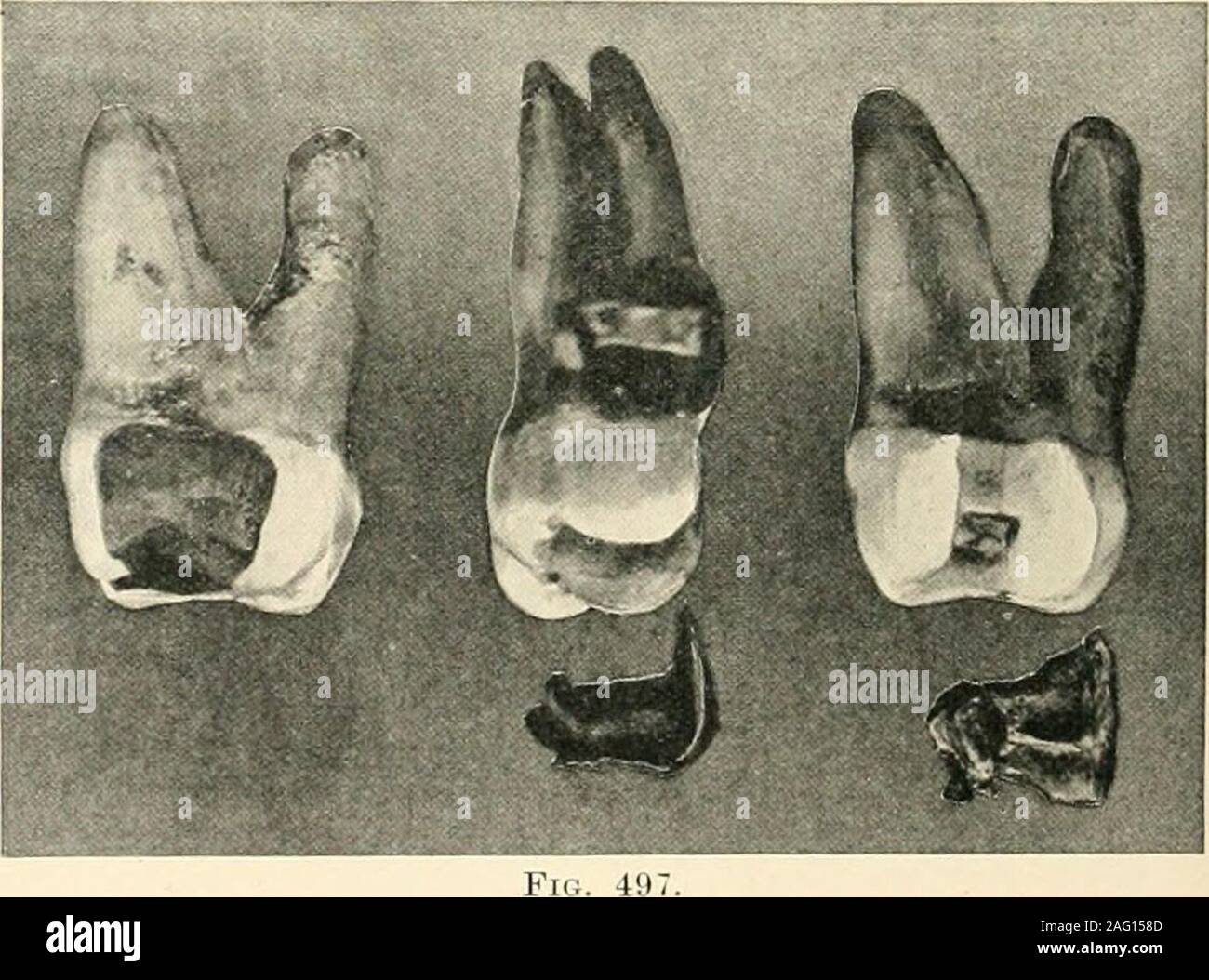 . The science and practice of dental surgery. te iji knifeedge margins