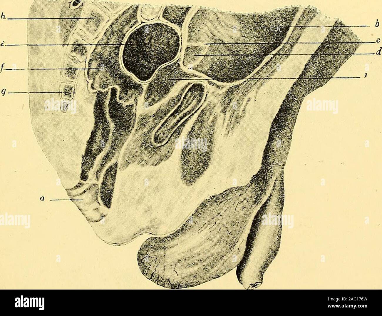 . Manual of antenatal pathology and hygiene : the foetus. §.Ju Femoral?^ head. THE PELVIS 117 The sacrum is quite straight, or has only a slight anterior con-cavity in the foetus. Its wings are little developed, so that the lengthof the bone is greater than its breadth, dolichohieric, and the sacralindex 76°; but, while this is the generally accepted statement, A.Thomson {loc. cit., p. 372) has asserted that it is platyhieric with anindex of 100°. The iliac bones have an almost inappreciable anteriorconcavity, and their angle of divarication is large. The pubic bonesare stumpy, and the symphys Stock Photo