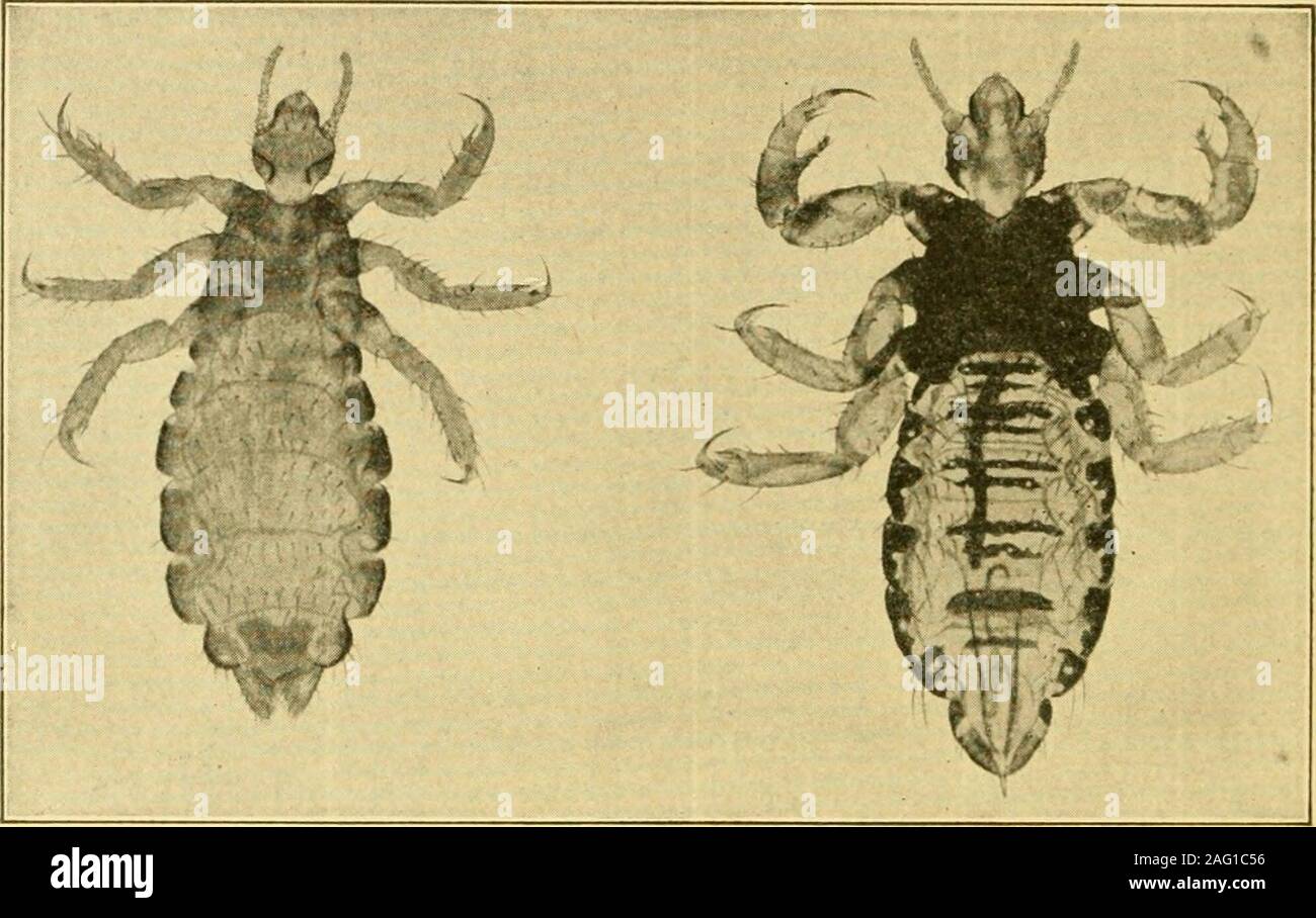 . Sanitary entomology; the entomology of disease, hygiene and sanitation. body louse, P. corpor^s, lives usually onthe body and in the clothing and is very rarely found on the head.The pubic louse, Phthirus pubis, is usually found on tlie hairs m thepubic region but may occur in other hairy parts of the body. ^This lecture was presented June 17, 1918, and distributed the same day. It hasbeen greatly revised. 301 302 SANITARY ENTOMOLOGY The body, head, and pubic lice are found on all races of men andseem to show some varietal differences according to the host. Noneof these species occurs on any Stock Photo