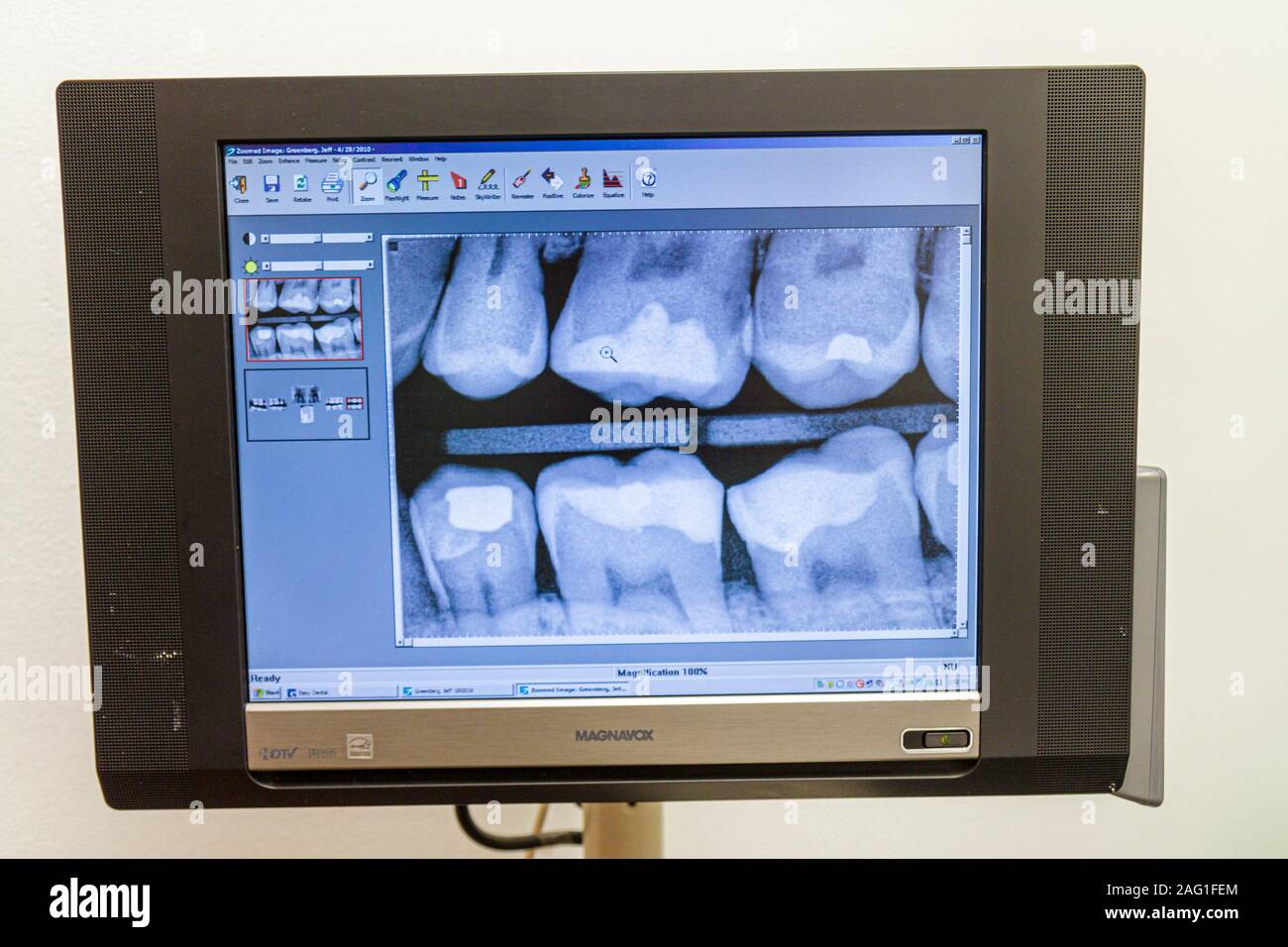 Miami Florida,Coral Gables,dentist office,x ray,teeth,fillings,FL100430140 Stock Photo