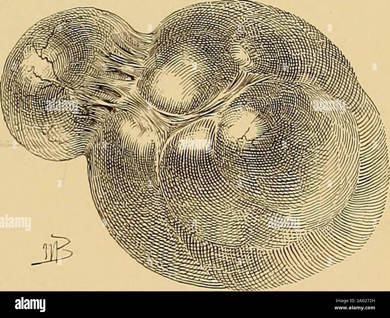 Utero ovarian ligament hi-res stock photography and images - Alamy