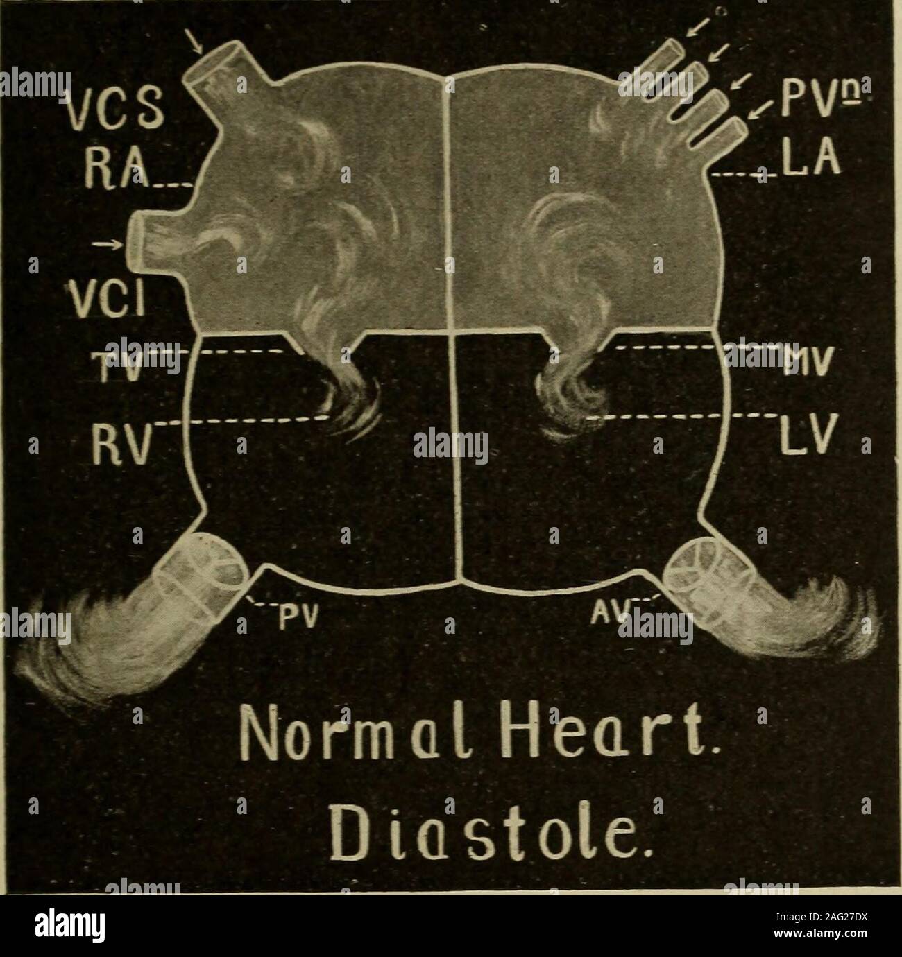 . Medical diagnosis for the student and practitioner. onstant supply of bright, red. arterial blood that has undergoneventilation and purification in the pulmonary air cells. During the recurring periods of ventricular relaxation (diastole) whichfollow each ventricular contraction, the blood passes from the auricles intothe ventricles through the opened auriculo-ventricular valves; the mitral onthe left, the tricuspid on the right. THE EXAMINATION OF THE HEART 457 Systole.—With the initiation oi systole ipresphygmic period) thesevalves abruptly close (first sound) the inlets to prevent backrlo Stock Photo