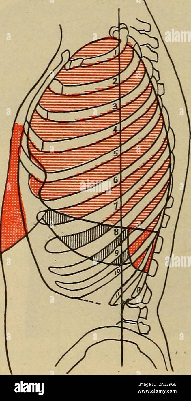 . Medical diagnosis for the student and practitioner. Fig. 93.—Percussion areas, normal chest(anterior surface). Lungs—red. Liver—horizontal black lines. Relative cardiacdulness—vertical black lines. Absolutecardiac dulness—cross-hatching. Stomachtympany—oblique red lines. This repre-sents the incomplete cardiac area obtain-able by flat-finger percussion in the normalheart. The more modern methods closelyapproximate the x-ray outline and shouldbe used^exclusively. Fig. 94.—Percussion areas (normalchest, posterior surface), a, a. Lungs.b, b. Pleural space, c. Spleen, c. Liver.d, d. Kidneys. Are Stock Photo