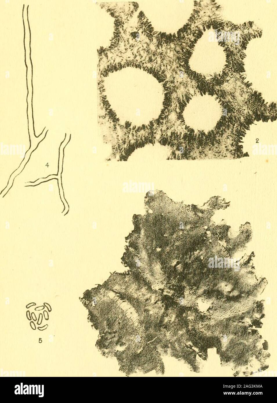 . Report of the State Entomologist on injurious and other insects of the state of New York. &lt;i. Fig. 1-5 PORIA SULPHURELLA (Peck) Sacc.Fig. 6 PORIA FIMBRIATELLA (Peck) Sacc. Plate 23 i6s Daedalea siilphurella Peck 1 Photograph of small fragments from the type collection, x 2. 2 Microphotograph of vertical section through the hymenium. X 160. 3 Hyphae from the subiculum. 4 Mature spores. 166 N. Y, State Botanists Report, 1917 :w*i Stock Photo