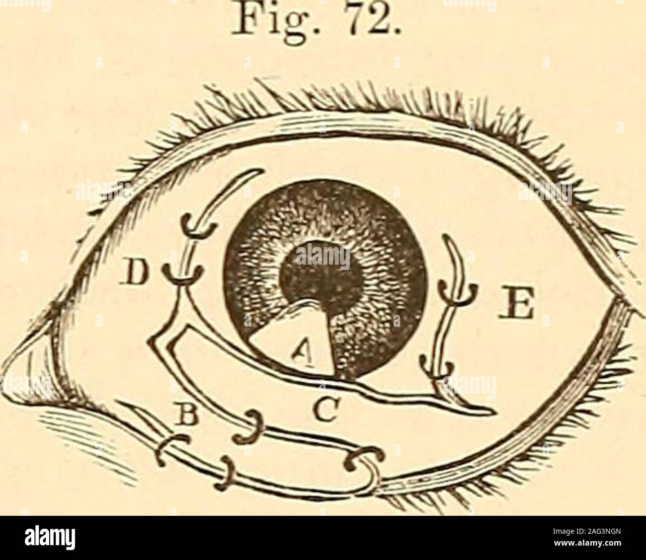 . A treatise on the diseases of the eye. In the next place, two flaps of conjunctiva were formed, one from thesurface of the globe, near the inner extremity of the raw surface, the otherfrom the surface of the globe, near the outer extremity. I first marked out,with a Beers knife, a flap of conjunctiva (B, Fig. 71), nearly a quarter of an 1 R. L. 0. H. Rep., 3, 216. * Prager Vierteljahrschrift, xi. 161. s R. L. 0. H. Rep., 3, 253. SYMBLEPHARON. 195. inch in breadth, and two-thirds of an inch in length, with its base at thesound conjunctiva, bounding the inner extremity of the exposed raw surfa Stock Photo