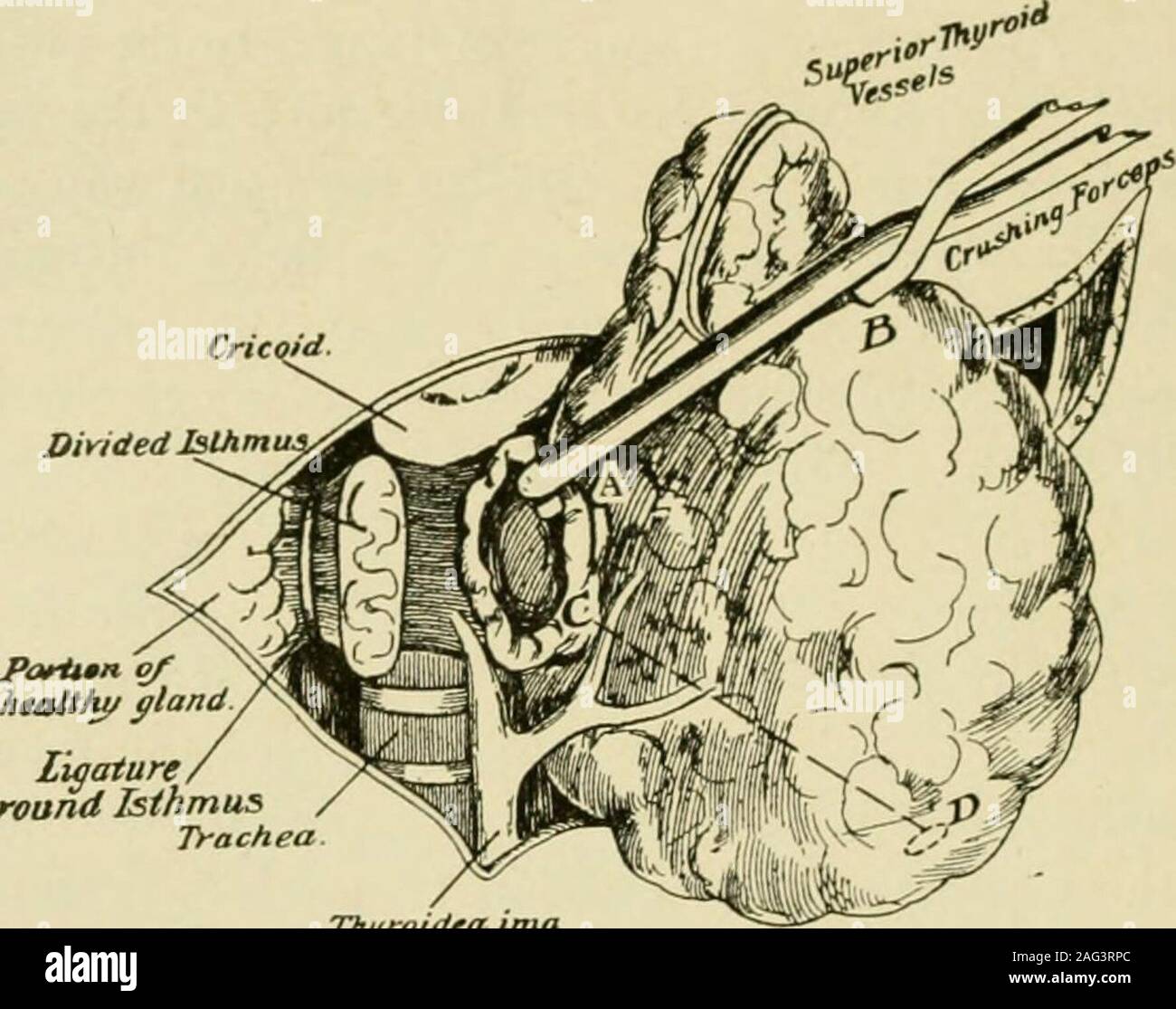 Lobe of glandular tissue hires stock photography and images Alamy