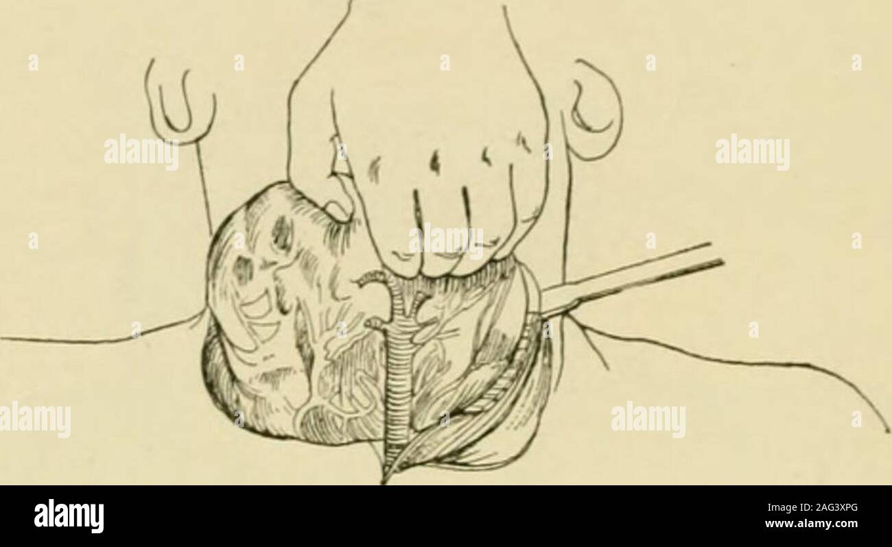 membranes séreuses de la cavité abdominale