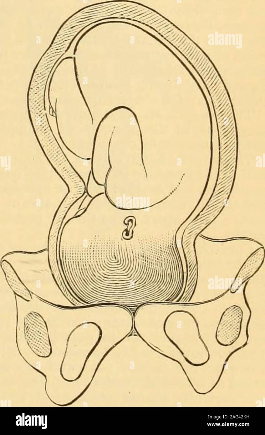 A Reference handbook of the medical sciences : embracing the entire range  of scientific and practical medicine and allied science. mnii, and, when  seen in a pure state, it is duesolely