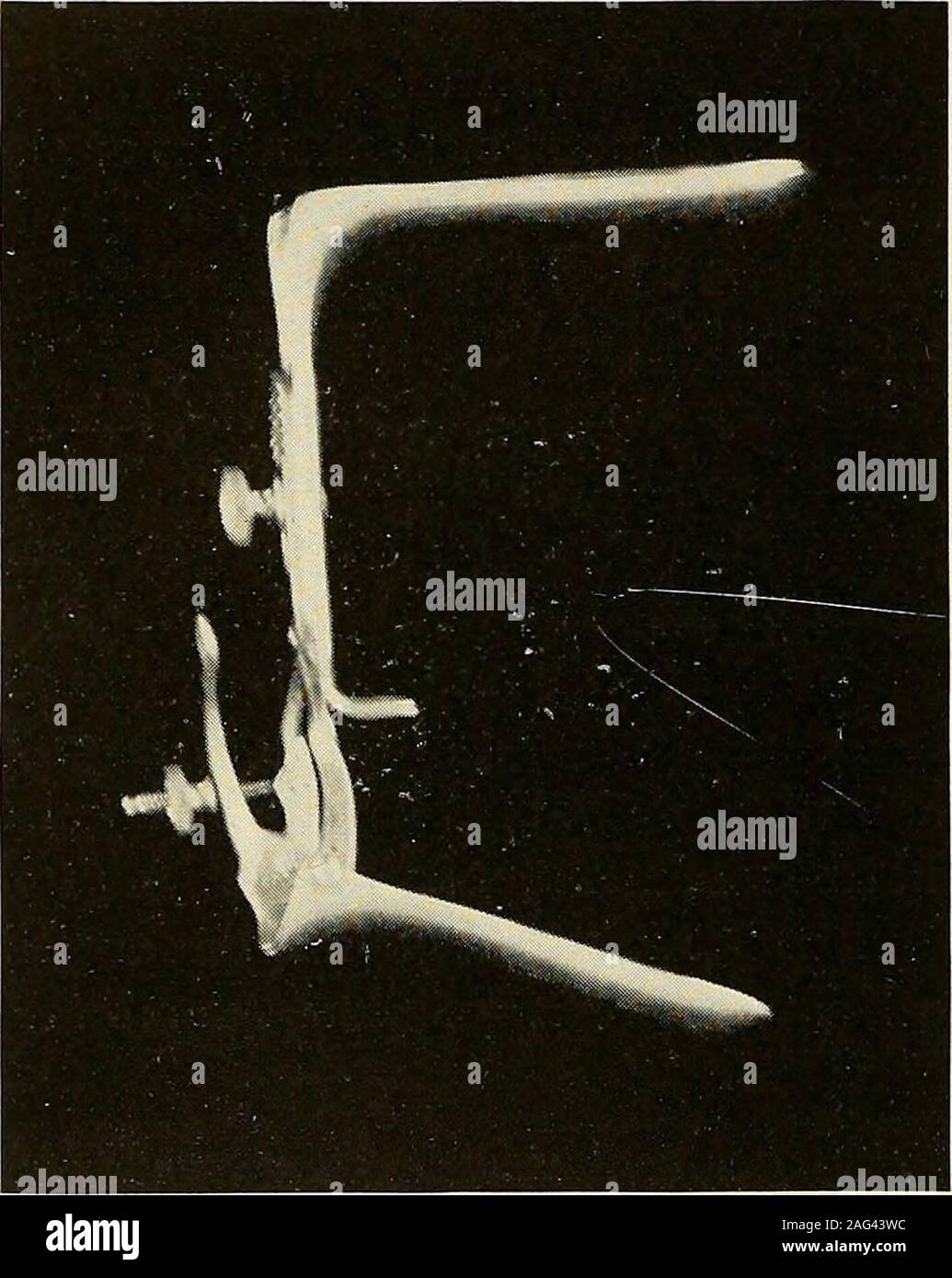 Inflamed structures hires stock photography and images Alamy