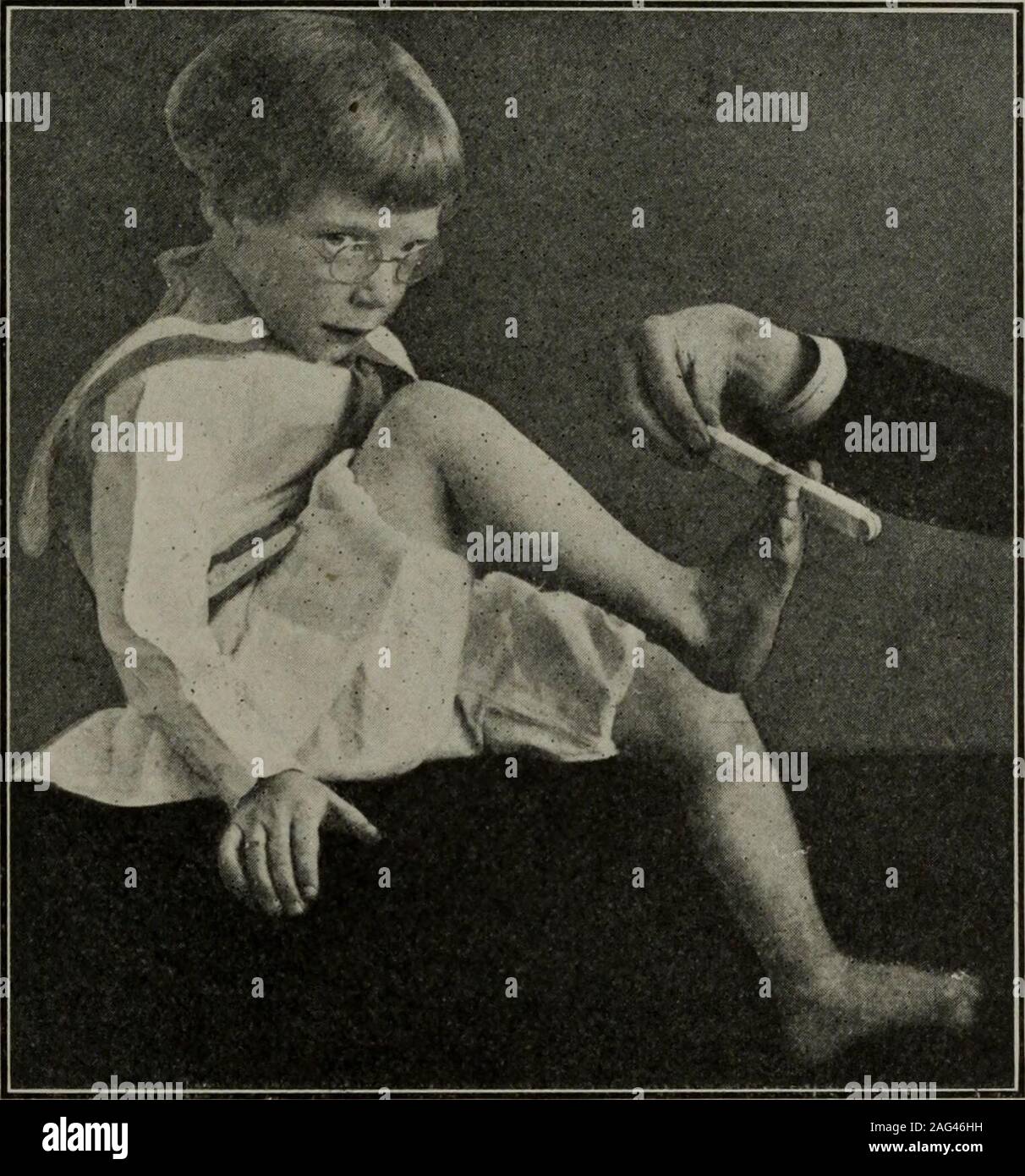 Tabes dorsalis hires stock photography and images Alamy