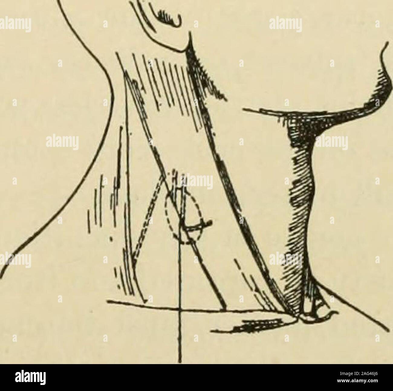 . Manual of operative surgery. Fig. 346. Fig. 347.—Superficial cervical nerves. The patient lies