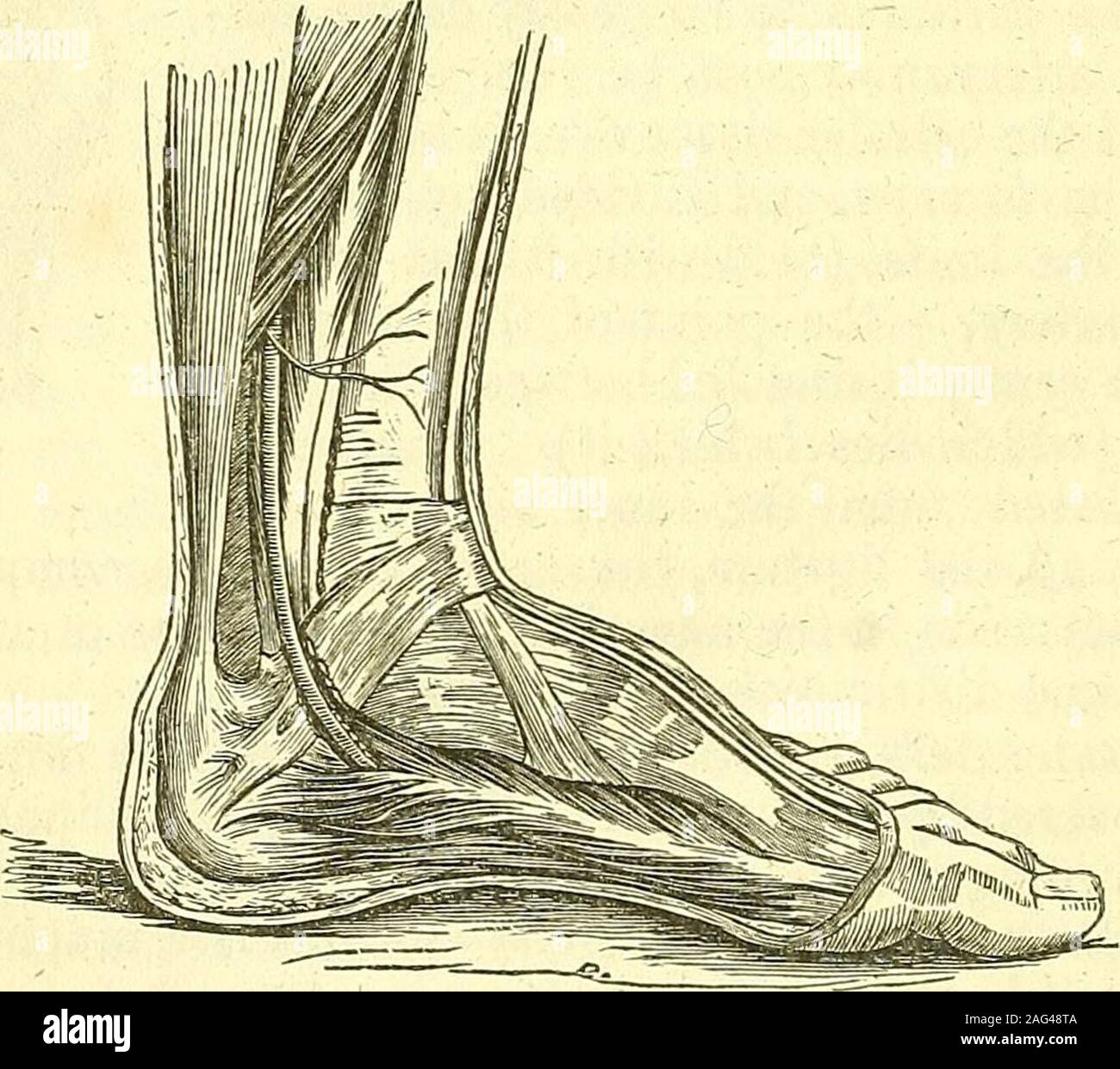 . The principles and practice of modern surgery. ssarily be wounded. They should be at-tempted, however, in case of wounds—but for aneurisms of these arteries,it is necessary to tie the internal or common iliac. XVI. The Popliteal artery may be tied by cutting through the skinand fascia lata for the extent of three inches on the outer border of thetendon of the semi-membranosus muscle—the patient being placed onhis face, with his knee straight. On pressing that tendon inwards, theartery may be felt. Its vein, which lies superficial and rather externalto it, must be cautiously separated and dra Stock Photo