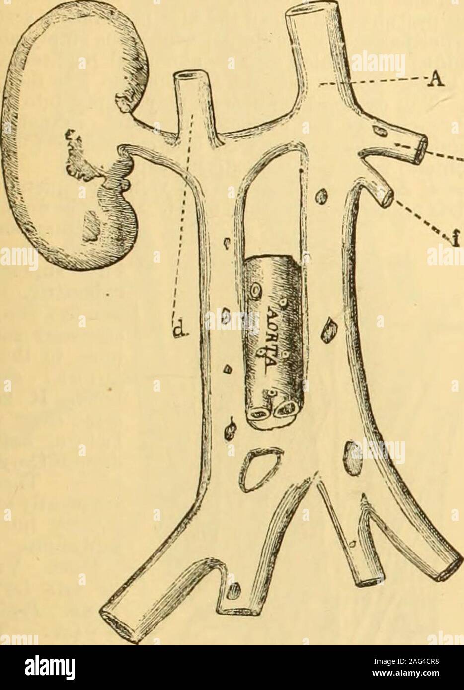 . A Reference handbook of the medical sciences : embracing the entire range of scientific and practical medicine and allied science. Fig. 4515.—The In-ferior Cava con- 608 REFERENCE HANDBOOK OF THE MEDICAL SCIENCES. Veins.Veins. vein has the usual mode of termination in the heart; (b)where it terminates in the superior vena cava. The common iliac veins may not join at the usualplace ; the left common iliac, after sending a branch acrossto join the right, may pass up on the left side of the aorta. —e Fio. 451G.—Case of Double Inferior Vena Cava, the two Common Iliacsbeing joineil by a Transvers Stock Photo