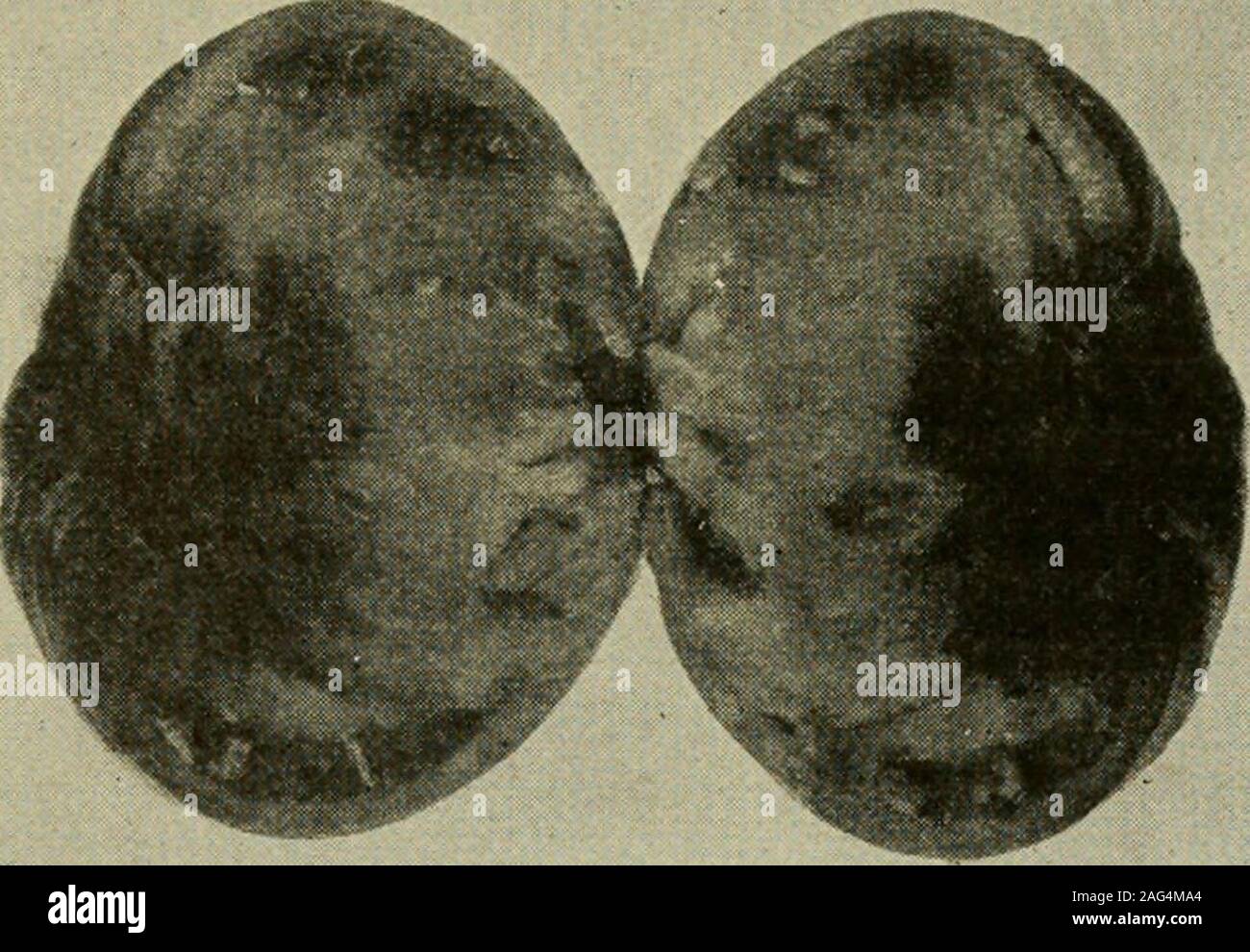 . Insect enemies and diseases of the tomato. Fig. 18.—Downy mildew on tomato fruit,dium late stage. Me- 15 BI.OSSOM.END KOT. Blossom - end rot(fig. 20j is a diseasedcondition of the blos-som end of the fruit.It is most common indry weather, especial-ly after a period ofrapid growth. Themost successful method of overcoming itis to water the soil.. Stock Photo