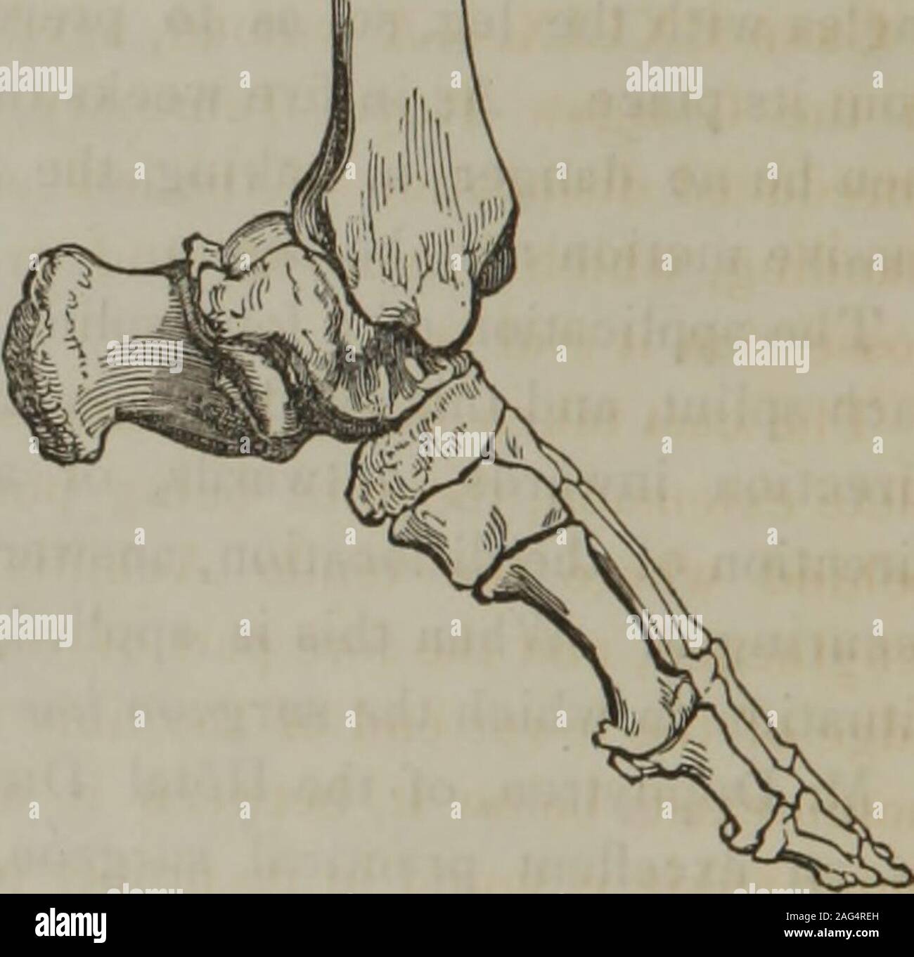 . A treatise on dislocations and fractures of the joints. sole. The
