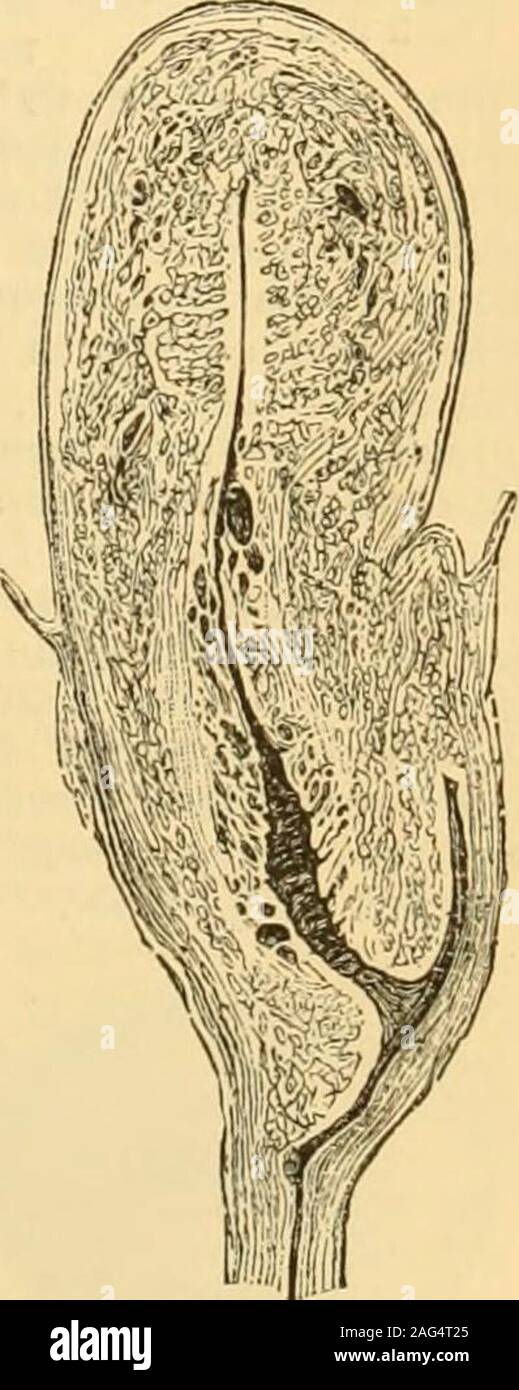 Ovarian ligaments hi-res stock photography and images - Alamy