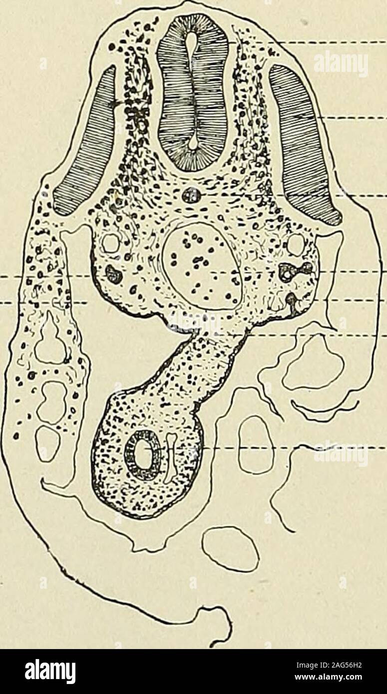 . Gynecological pathology; a manual of microscopic technique and diagnosis in gynecological practice, for students and physicians. -Transverse Section through Rabbit Embryo, showing Originop Wolffian Duct from Ectoderii. Wolffian Duct.—The excretory duct or Wolffian duct developsnear the ectoderm. According to some it develops only near, accordingto others partly from, and according to most recent views entirely from,the ectoderm. It may be seen in Fig. 83 that the Wolffian duct has notyet entirely separated from the ectoderm. The Wolffian duct grows Duct of Mueller —Celom. Med. canal m ftfUKk Stock Photo