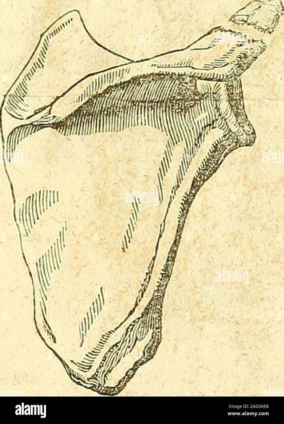 . The principles and practice of modern surgery. thefragment is restored to its place. This is alsoa rare accident; and Mr. Fergusson believesthat in some of the supposed cases of ligamentous union, the detachedportion was never united by ossification to the rest of the bone frombirth. Trea^men^.—The same bandages, &c., are to be applied as for fractureof the clavicle; but great care must be taken to raise the elbow thoroughly,so that the head of the humerus may be lifted up against the acromion,and keep it in its place. Moreover, no pad must be placed in the axilla;otherwise the broken part w Stock Photo