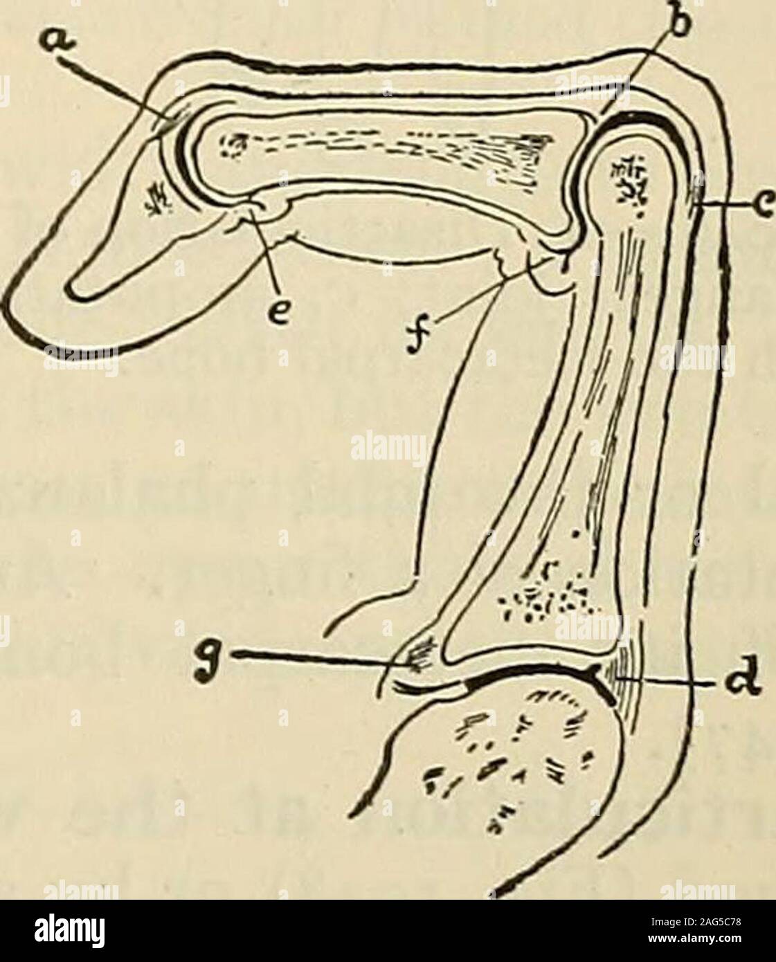 Terminalization Finger . Modern surgery, general and operative. to the bone, the flap is dis ...