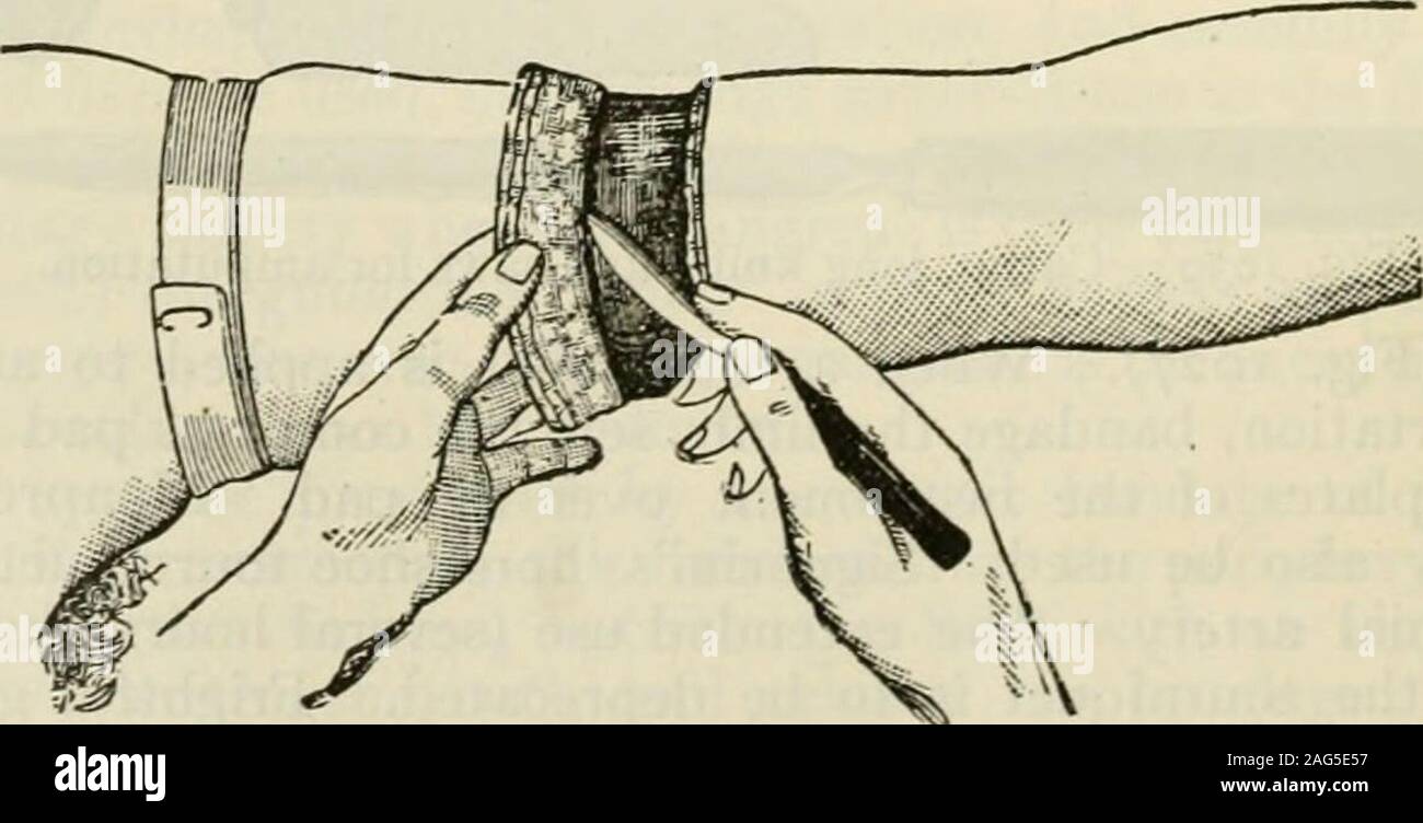 Kocher incision hi-res stock photography and images - Alamy