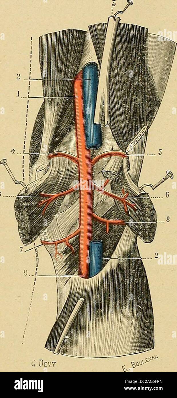 Traité d'anatomie humaine : anatomie descriptive, histologie,  développement. hène externe et, sous le nomàartère saphène externe,  laccompagnejusquà la partie moyenne de la jambe,ou même plus bas. 2°  Artères articulaires supérieures. —Elles