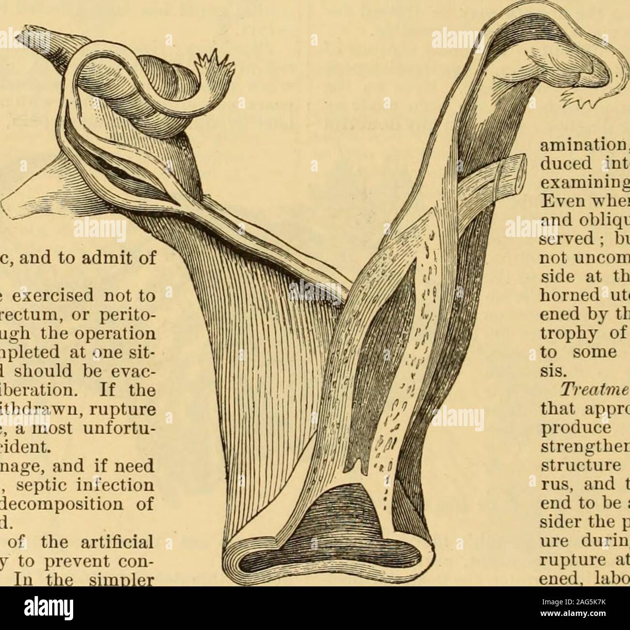 . A Reference handbook of the medical sciences : embracing the entire range of scientific and practical medicine and allied science. the uterus and oneexamining finger into the rectum.Even when impregnated its shapeand oblique position may be pre-served ; but the normal organ isnot uncommonly deflected to theside at this period, and the one-horned uterus may be so broad-ened by the physiological hyper-trophy of pregnancy as to leadto some confusion in diagno-sis. Treatment.—It is not unlikelythat appropriate treatment willproduce an enlargement andstrengthening of the muscularstructure of the Stock Photo