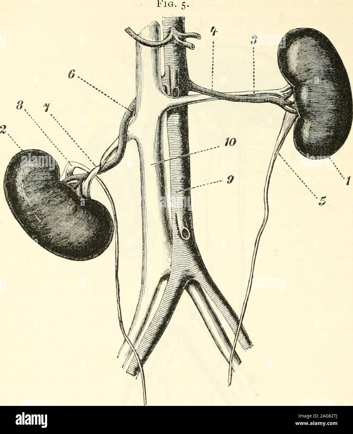 . Selected monographs, comprising Albuminuria in health and disease. ..?i 1. Left kidney. 2. Right kidney. 3. Left renal vein kinked and twisted. 4. Right renal vein compressed. 5. Ureter. 6. Abdominal aorta. 7. Vena cava inferior. Tliere are, perhaps^ few pathological processes which havebeen so accurately investigated as the coarser disturbancesof circulation in the renal vein. Max Hermann and Ludioig(i 14) found that after tying the renal vein the tubuli uriniferibecame completely closed in consequence of the obstructionto the return of the blood, so that the secretion of urineceased. If th Stock Photo
