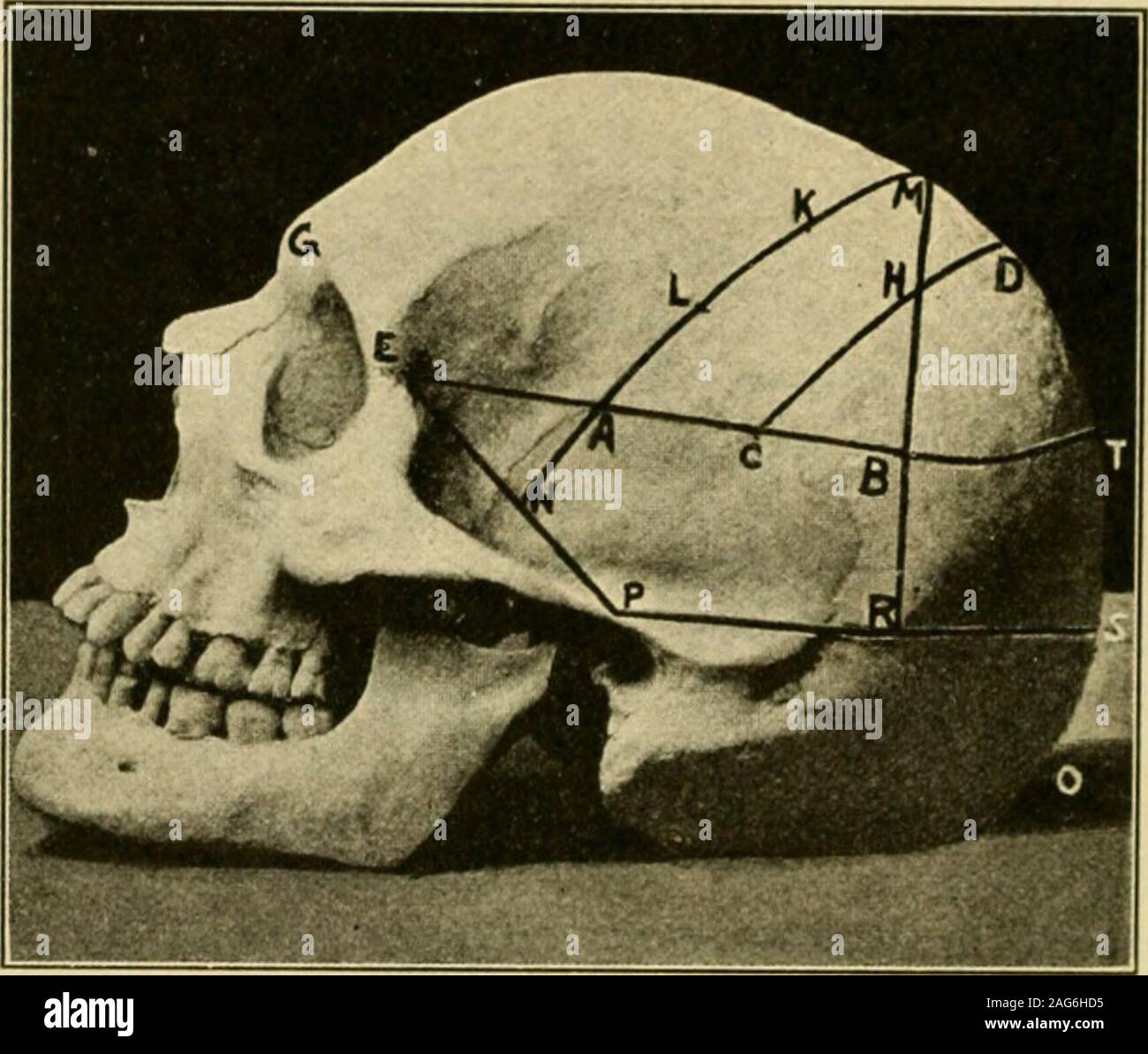 Mastoid process hi-res stock photography and images - Page 3 - Alamy