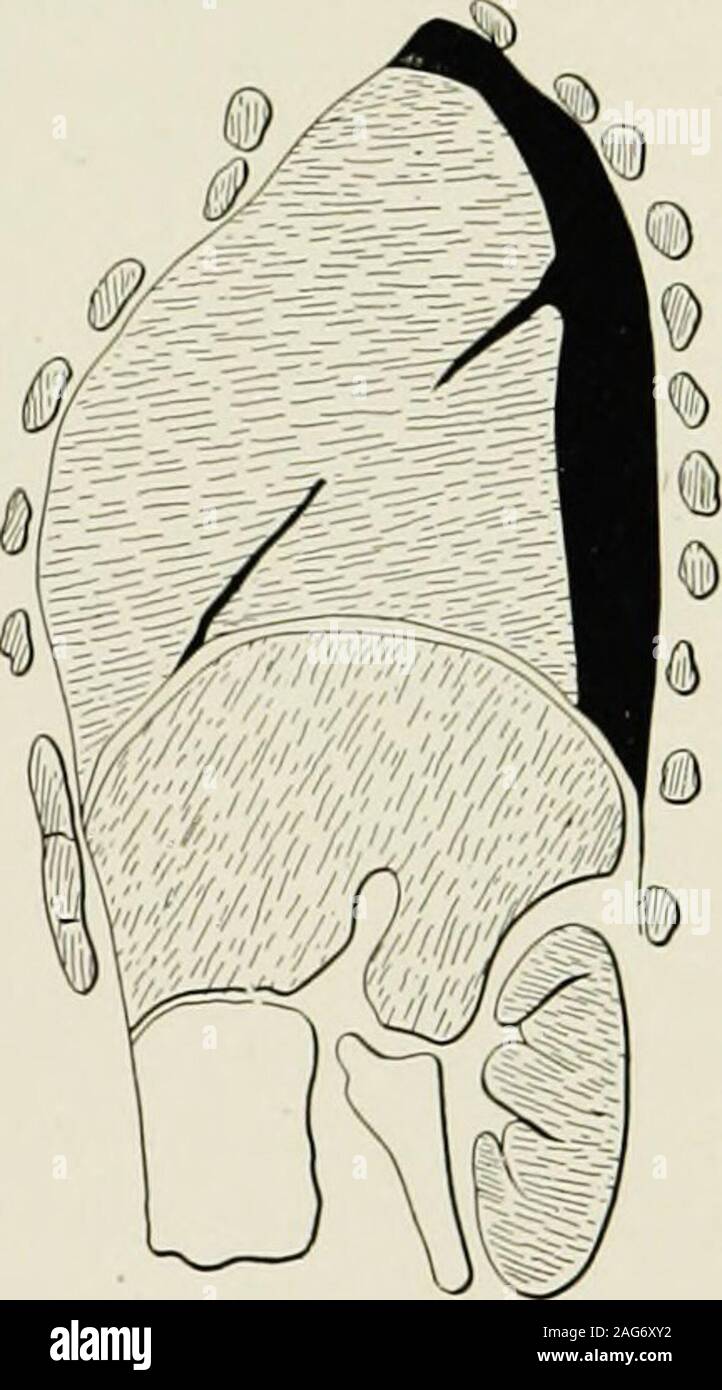 . The diseases of infancy and childhood : designed for the use of ...