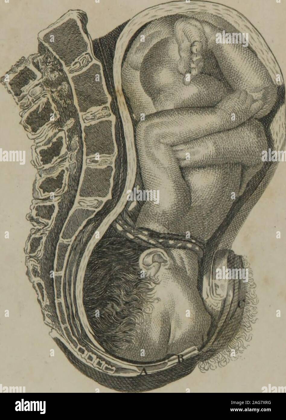 . An introduction to the practice of midwifery. BEING BELOW THE PUBES, AND THEVERTEX IN THE CONCAVITY OF THE OS SACRUM ; THE WA-TERS LIKEWISE BEING ALL DISCHARGED, THE UTERUSAPPEARS CLOSELY JOINED TO THE BODY OF THE CHILD,ROUND THE NECK OF WHICH IS ONE CIRCUMVOLUTION OFTHE FUNIS. A The inferior part of the rectum. B The perinaeum. C The left labium pudendi. When the pelvis is large, the head, if small, will come alongin this position, and the child be saved ; for, as the head ad-vances lower, the face and forehead will stretch the partsbetween the frsenum labiorum and coccyx, in form of a larg Stock Photo