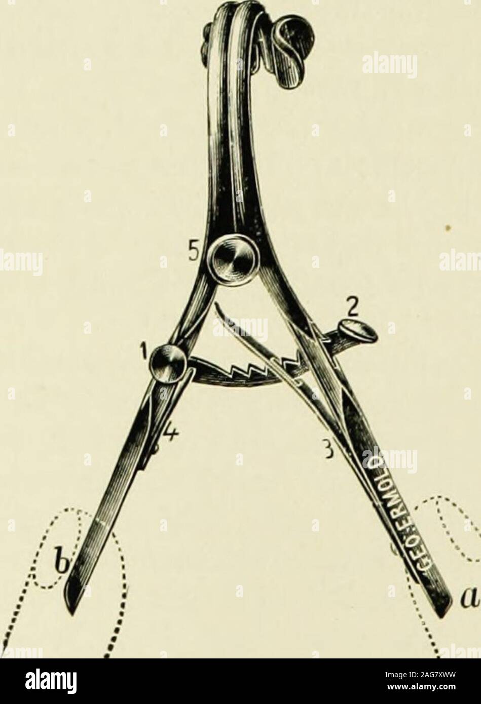 . The diseases of infancy and childhood : designed for the use of students and practitioners of medicine. Fig. 76.—The ODwyer extractor.. Ficj. 77.—Gag of the ODwyer set. DIPHTHERIA 389 Indications.—We intubate when a progressive dyspnea, which pro-duces sensible exhaustion, exists. ODwyer never tubed the larynxexcept as a dernier ressort, and did not approve of early tubage.If an infant or child shows marked retraction of the suprasternalnotch, retraction of the epigastrium, and stridor, with accompanyinglabored breathing, we should at once proceed to tube the larynx. Mode of Operating.—The p Stock Photo